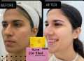 Turmeric & Kojic Acid Kem Cot Thai Whitening Soap -100gm Premium. 