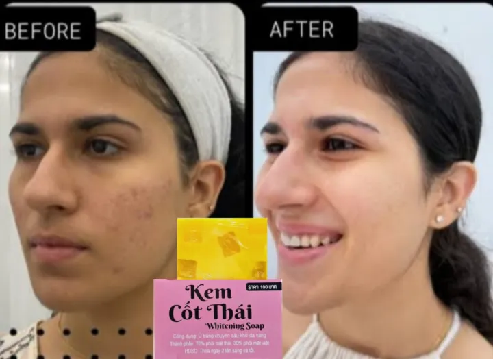 Turmeric%20&%20Kojic%20Acid%20Kem%20Cot%20Thai%20Whitening%20Soap%20-100gm%20Premium%20-%20Image%206