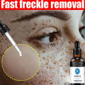 melasma and pekas remover serum,Nature dark spot remover for face,freckle remover cream anti aging cream. 