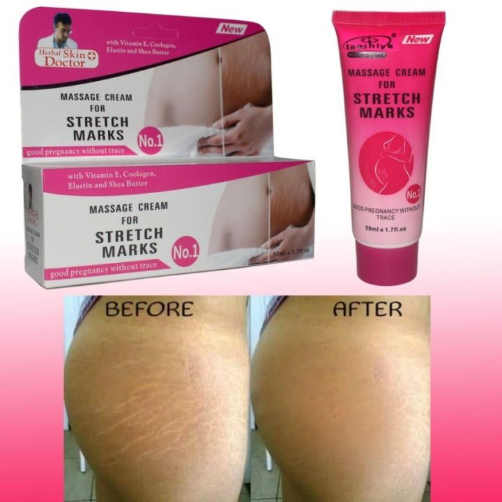 View of Herbal Skin Doctor Massage Cream for Stretch Marks – 50ml | Daraz.com.bd