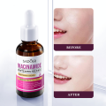 Sadoer Niacinamide Whitening Face Serum Shrink Pores Fade Dark Spots Improve Melanin Moisturizing Brighten Nourishing Skin Care-30ml. 