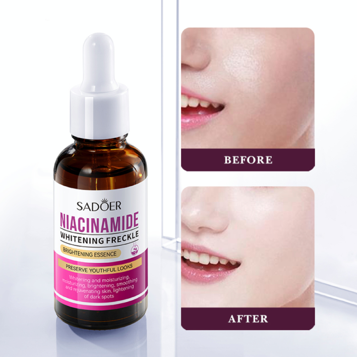 Sadoer Niacinamide Whitening Freckling Serum-30ml | Daraz.com.bd