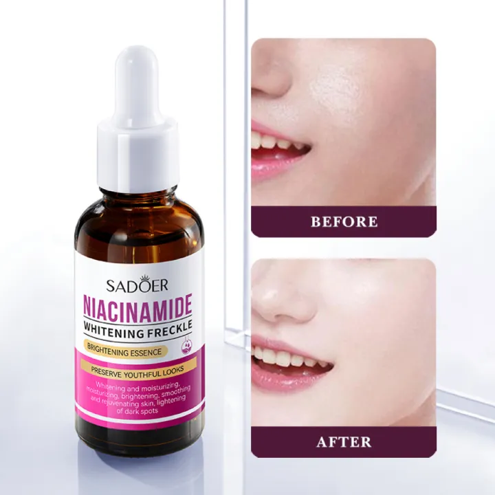 Sadoer%20Niacinamide%20Whitening%20Face%20Serum%20Shrink%20Pores%20Fade%20Dark%20Spots%20Improve%20Melanin%20Moisturizing%20Brighten%20Nourishing%20Skin%20Care-30ml%20-%20Image%203