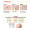 Cosrx Acne Pimple Master Patch 24 Patch | Korea. 