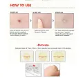 Cosrx Acne Pimple Master Patch 24 Patch | Korea.