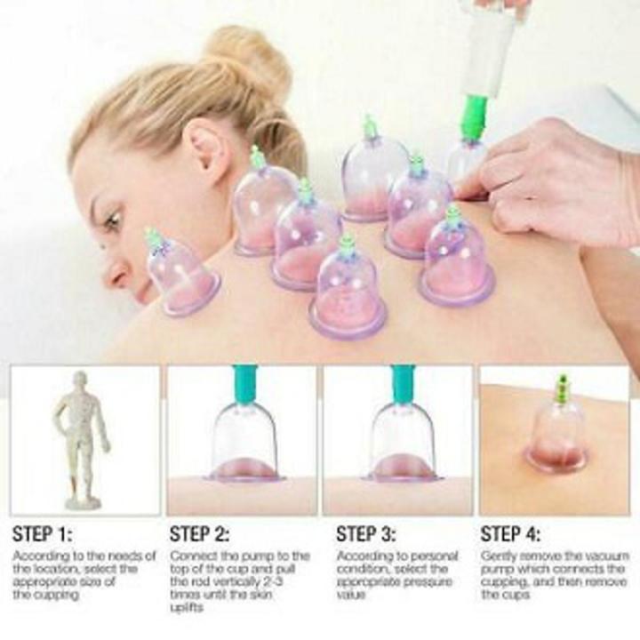 Hijama Set/ Cupping Set/ Massage Cupping/ Dry Cupping Set 12Pcs