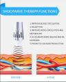 mini extracorporal shockwave therapy device pain amangement.