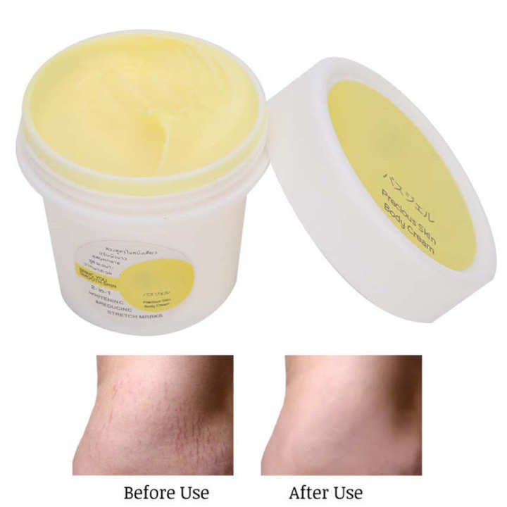 Stretch%20Repair%20Cream%20Remover%20Removal%20Pregnancy%20Postpartum%20Treatment%20Skin%20Repairing%20Tool%20-%20Image%207