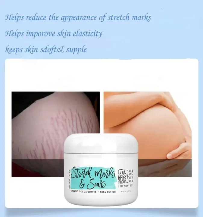 Natural%20Organic%20Postpartum%20Stretch%20Mark%20Removal%20Skin%20Repair%20Cream%20Body%20Pregnancy%20Scar%20Cream%20For%20Women%20-%20Image%203