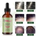 59ml Mielle Hair Growth Essential Oil Rosemary Mint Scalp Hair Strengthening Oil Nourishing Repair Split Ends Dry Hair Care Oil FeeoiF. 
