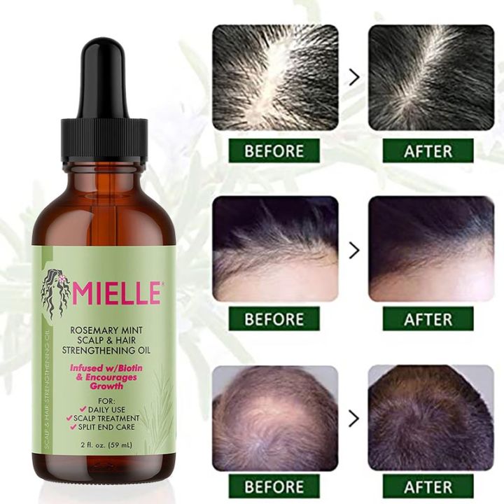 59ml%20Mielle%20Hair%20Growth%20Essential%20Oil%20Rosemary%20Mint%20Scalp%20Hair%20Strengthening%20Oil%20Nourishing%20Repair%20Split%20Ends%20Dry%20Hair%20Care%20Oil%20FeeoiF%20-%20Image%202