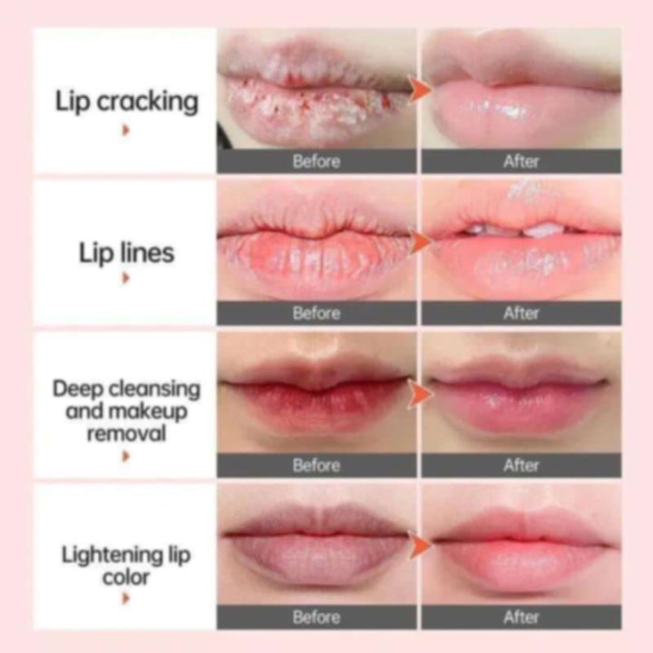 JoyPretty%20Bubble%20Lip%20Mask%20Anti-Cracking%20Moisturize%20Lips%20Care%20-%20Image%203