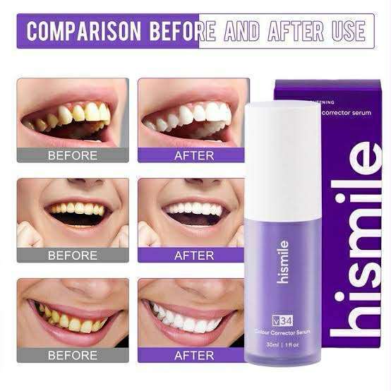Hismile%20V34%20Purple%20Color%20Corrector%20Teeth%20Toothpaste%20Effective%20Whitening%20Teeth%20Mousse%20Oral%20Cleaning%20Whitening%20Toothpaste%20Product%20-%20Image%204