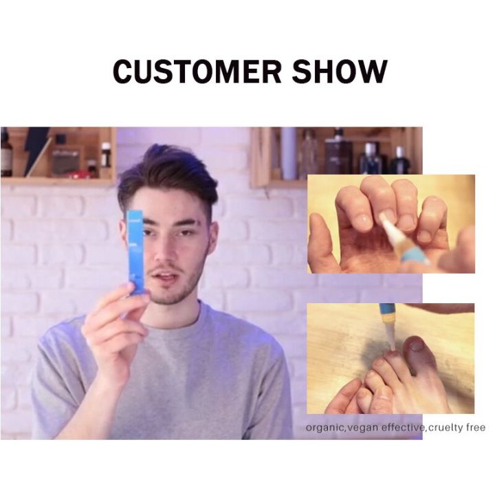 Repair%20Nail%20Fungus%20Treatments%20Essence%20Foot%20Care%20Serum%20Toe%20Nails%20Fungal%20Removal%20Gel%20Anti-Infection%20Onychomycosis%20Nail%20Care%204ml%20-%20Image%203