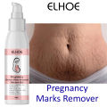 EELHOE Scar Removal Cream Gel Burn Surgical Scar Cesarean Scar Repairing Stretch Marks Pigmentation Corrector. 