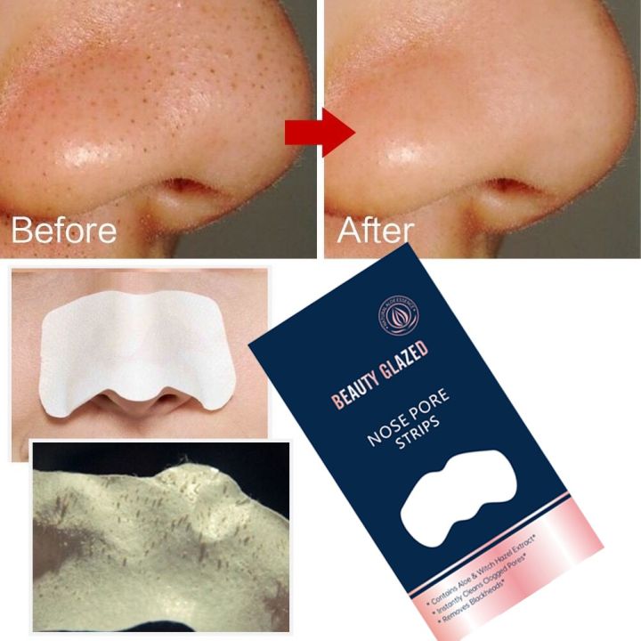 Beauty%20Glazed%20Nose%20Pore%20Strips%20blackhead%20remover%20-%205%20pcs%20-%20Image%203