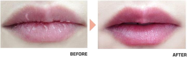 Carenel%20Pomegranate%20Lip%20Night%20Mask%205g%20-%20Image%207