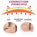Pexmen 10/20/50/100Pcs Ingrown Toenail Correction Stickers Toenail Corrector Patch Keep Nails Healthy Relieve Pain.