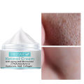 Whitening Freckles Cream Remove Melasma Dark Spots Lighten Melanin Melasma Remover Moisturizing Brighten Face Skin Care TRSTAY. 