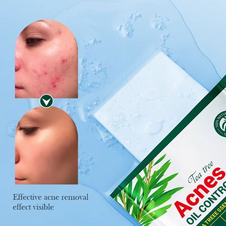 SADOER%20Tea%20Tree%20Acnes%20Oil%20Control%20Facial%20Sheet%20Mask-%2025g%20-%20Image%203