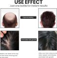 Kirkland Minoxidil 5% for Beard & Hair Growth.
