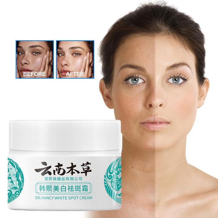 20g%20YunNan%20Herb%20Whitening%20Freckles%20Cream%20Remove%20Melasma%20Fade%20Dark%20Spots%20Shrink%20Pores%20Brightening%20Anti-aging%20Skin%20Care%20Product%20-%20Image%205