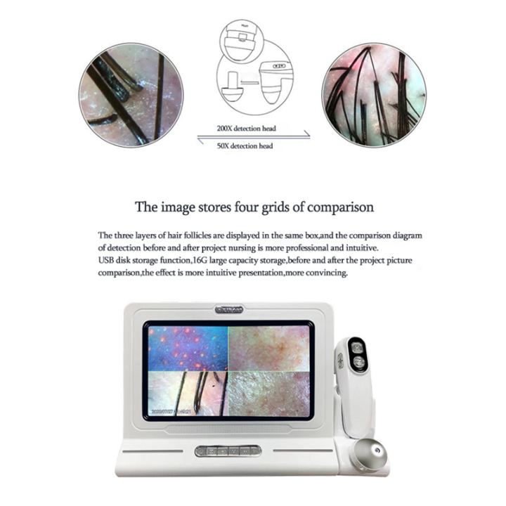 Digital%20Microscope%20Magnifier%20Skin%20Hair%20Blackhead%20Follicle%20Scalp%20Detector%20Skin%20Analyzer%20Set%20-%20Image%207