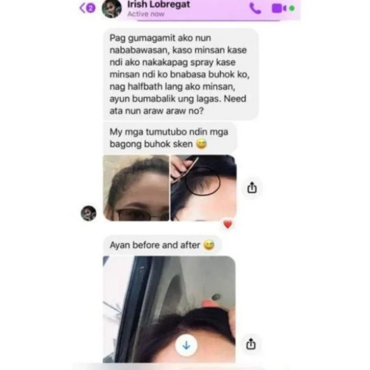 TRSTAY%20Hair%20Spray%20Hairloss%20Hair%20Tools%20Rosemary%20Oil%20for%20Hair%20Professional%20Brazilian%20Keratin%20New%20Hair%20Growth%20Essence%20Care%20Products%20-%20Image%206