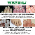 Jaysuing Ginger Nail Treatment Moisturizer for soft nails, nail brightening, nail fungus, nail repair, hand and foot nails.