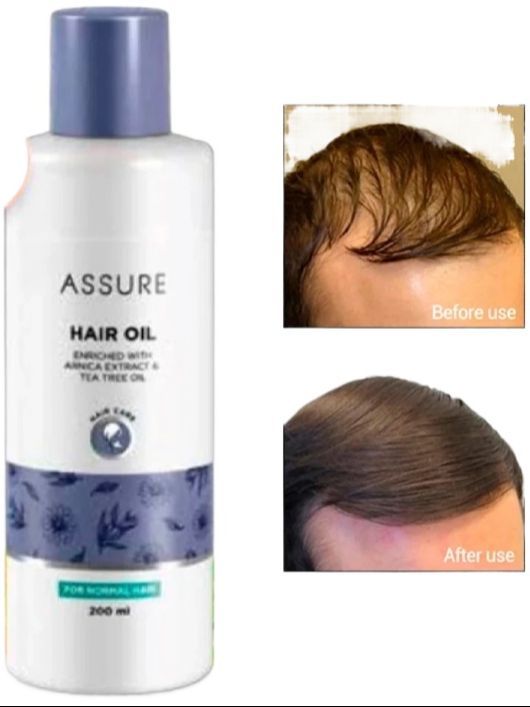Assure hair oil 200ml-9821765434
