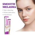 Melasma Remover Cream Removal Dark Pigment Brighten Cream Face Fade Melanin Cream Nicotinamide Brightening Moisturizing Emulsion.