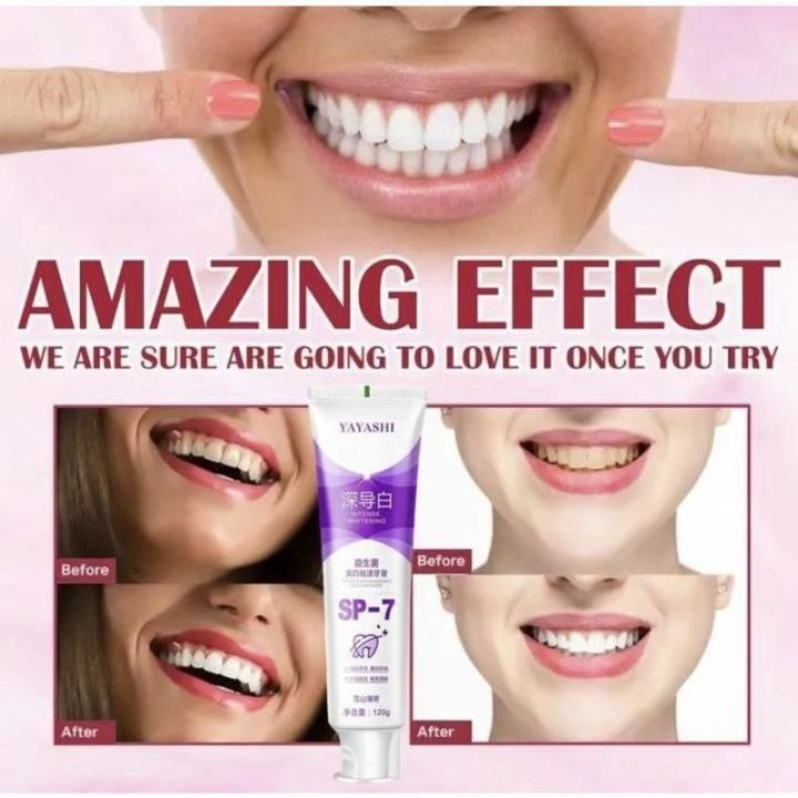 SP-7%20Probiotic%20Toothpaste,%20Yayashi%20Sp-7%20Toothpaste%20Whitening%20-%20Image%204