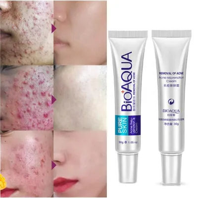 BIOAQUA%20Pure%20Skin%20Acne%20Rejuvenation%20&%20Cream%20-%2030g%20-%20Image%204