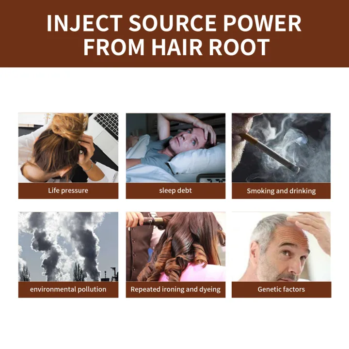 Chines%20Herbal%20Polygonum%20multiflorum%20hair%20soap%20Blacken%20hair%20and%20prevent%20hair%20loss%2060g-Get%201%20Foam%20Net%20Free%20-%20Image%205