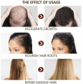 Disaar – Hair Essential Oil Anti – Hair loss. 