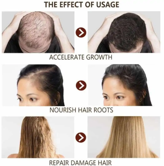 Disaar%20%E2%80%93%20Hair%20Essential%20Oil%20Anti%20%E2%80%93%20Hair%20loss%20-%20Image%202