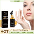 Vitamin C Serum Acne Pimple Removal Smooth Wrinkle Tighten Lift Fade Acne Marks Anti Aging Repair Moisturizing Whitening Essence.