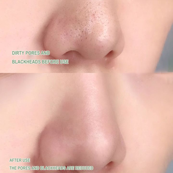Green%20Tea%20Mask%20Blackhead%20Remover%20Mask%20Acne%20Removal%20Cleaning%20Mud%20Green%20Tea%20Cleansing%20Stick%20Eggplant%20Masks%20Face%20Skin%20Care%20Masks%20-%20Image%205