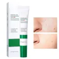 BIOAQUA Acne Removal Cream Anti Acne Treatment Repair Marks Moisturizing Blackhead Remover Facial Cream Skin Care-20gm.