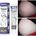 Stretch Marks Permanent Removal Cream Eliminate Body Belly Stretch Marks Swelling Marks Remove Skin Cracks. 