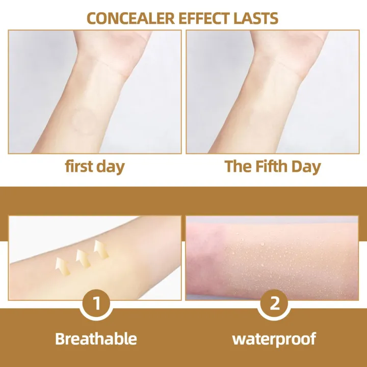 Invisible%20Concealer%20Sticker%20Skin%20Color%20Concealer%20Tattoo%20Stickers%20Cover%20Up%20Burn%20Scar%20Birthmark%20Invisible%20Patch%20Waterproof%20Tape%20-%20Image%206