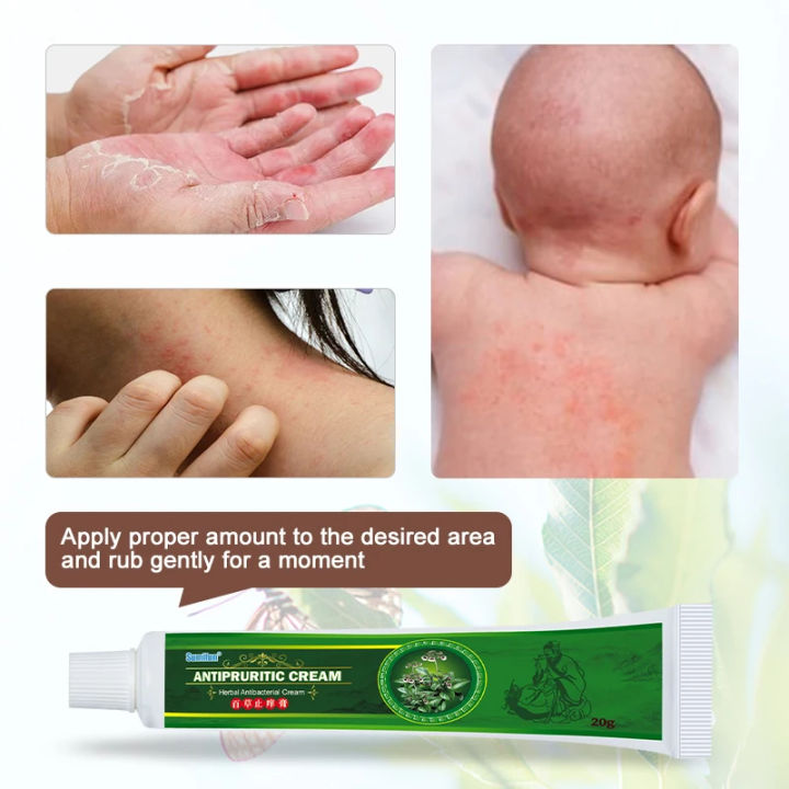 Sumifun Herbal Anti-Itch Cream 20g – Fast Relief for Eczema, Dermatitis ...