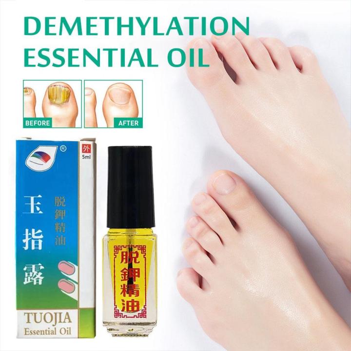 1pcs Tuojia Essential Oil Removal Of Onychomycosis Care Fungal Nail Toe Oil Infection Anti Paronychia Oil Nail Fungus