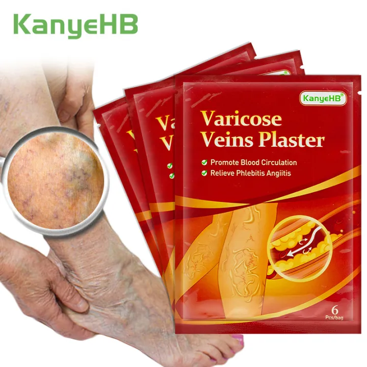 6Pcs%20Leg%20Patches%20For%20Varicose%20Veins%20Chinese%20Herbal%20Medicine%20Varicosity%20Angiitis%20Removal%20Phlebitis%20Spider%20Leg%20Veins%20Pain%20Plaster%20-%20Image%203