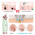 CkeyiN  Facial Cleaning 5 Tips Blackhead Remover Electric Vacuum Suction Blackhead Acne Extractor Pores Deeply Cleaning Tool Multifunctional Skin Care Beauty Device MR278G. 