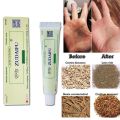 (New) zudaifu antibacterial ointment creams Psoriasis Eczema peeling herbal cream beige & Green. 