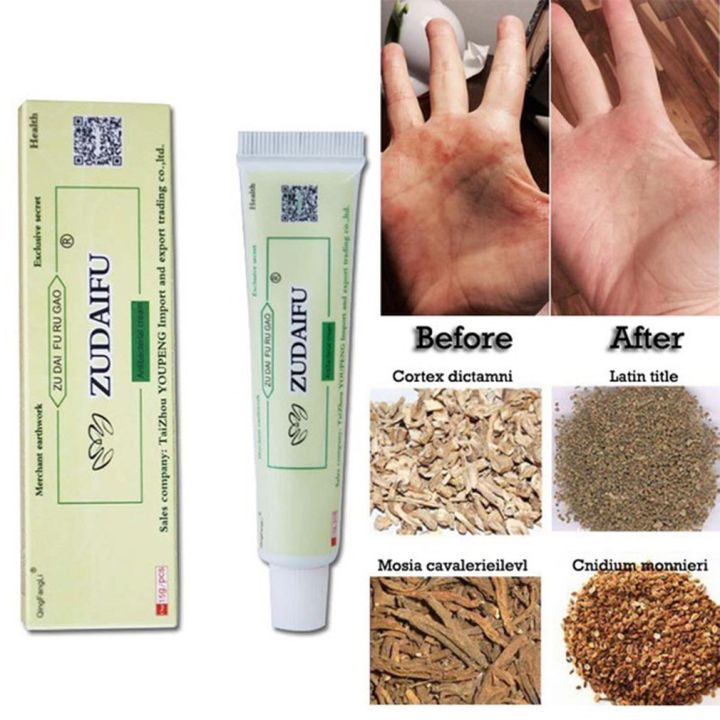 (New)%20zudaifu%20antibacterial%20ointment%20creams%20Psoriasis%20Eczema%20peeling%20herbal%20cream%20beige%20&%20Green%20-%20Image%205