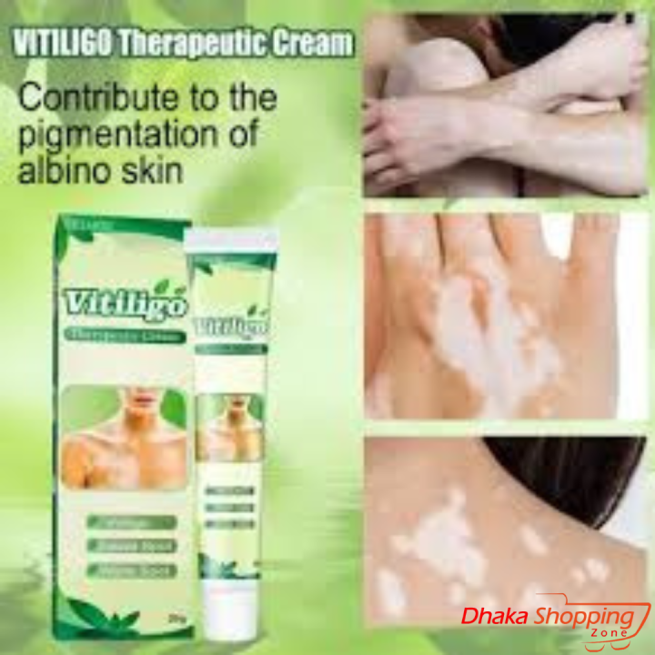 Vitiligo Treatment Cream Healthy White Spot Therapeutic Gel-Bath & Body Accessories - SL Discount Shop