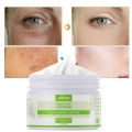 Kojic Acid Face Cream Whitening Remove Freckles Dark Spots Anti Aging Brighten Moisturizing Nourishing Korean Skin Care Health. 