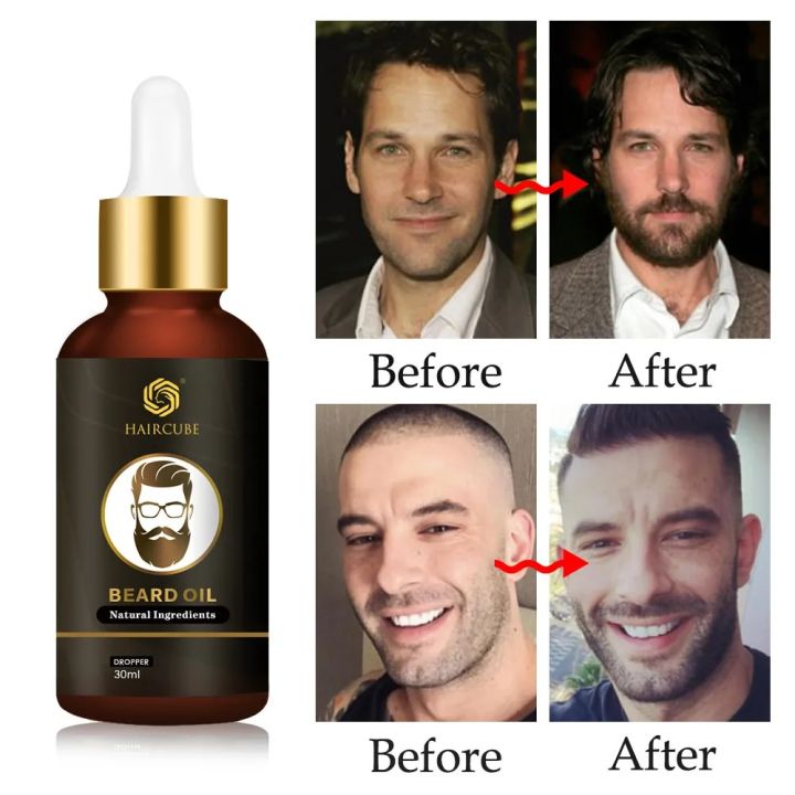 Beard%20Growth%20Essential%20Oil%20Natural%20Effective%20Thicken%20More%20Beard%20Nourishing%20Growth%20Oil%20For%20Men%20Beard%20Care%20Hair%20Growth%20products%20-%20Image%203